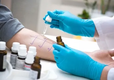Allergy Prick Test