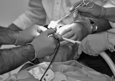 Cryobiopsy