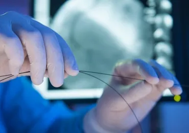 Endobronchial Stent