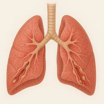 Asthma